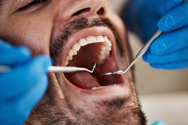 Sedation Dentistry